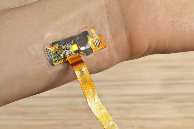 A medical device implanted into the skin
